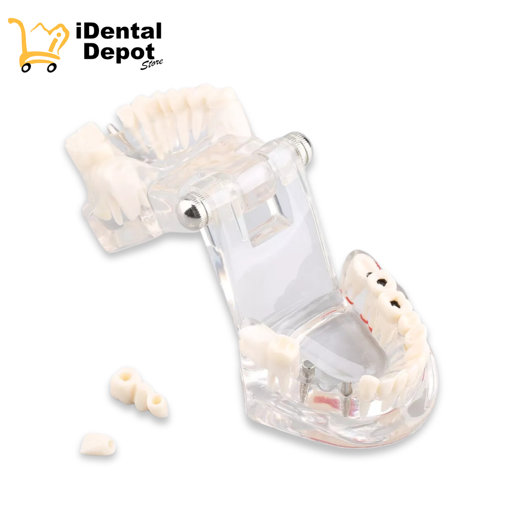 Tipodonto Didáctico Patologías-tx Implantes