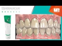 OPALESCENCE PASTA DENTAL C/12 4.7OZ