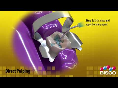 RECUBRIMIENTO PULPAR THERACAL LC KIT C/4 JERINGAS 
