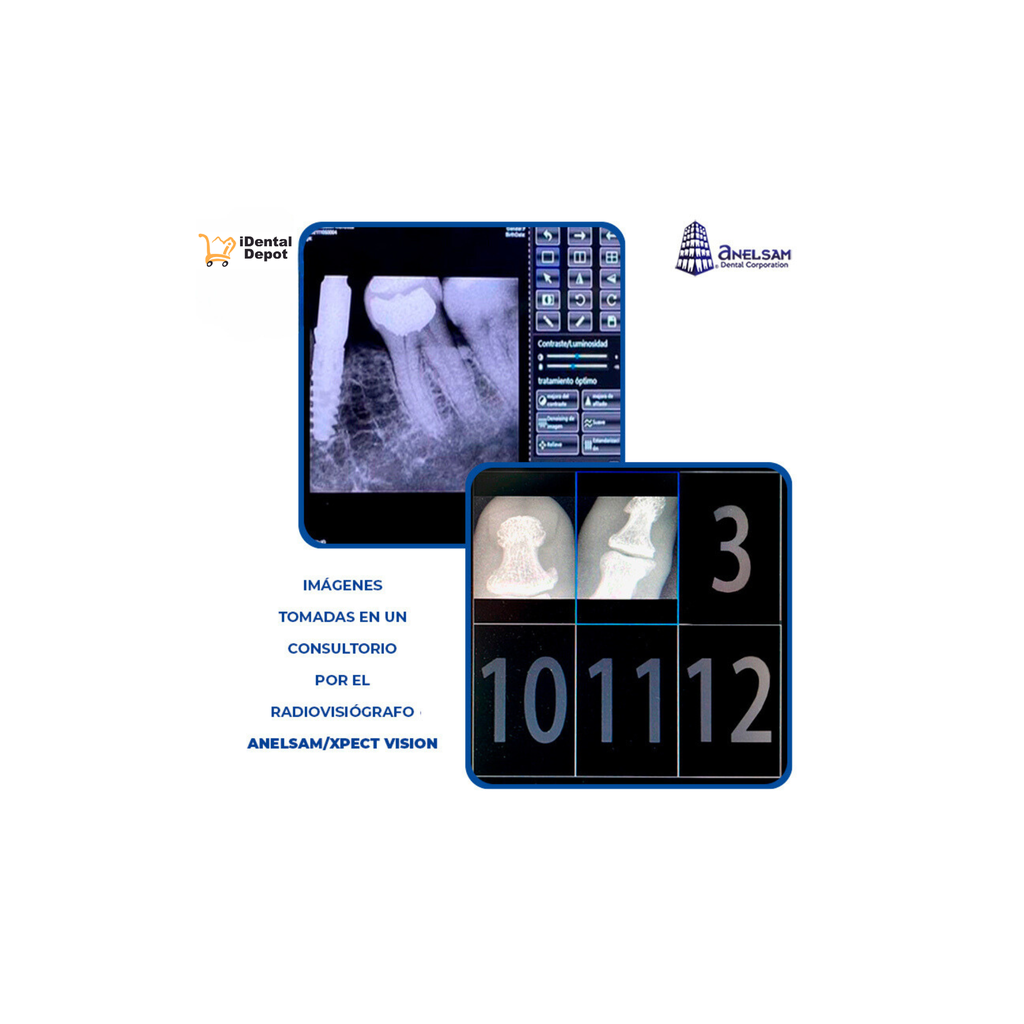 ECO-SENSOR DIGITAL ADULTO ANELSAM/XPECT VISION (GARANTIA DE 2 AÑOS)