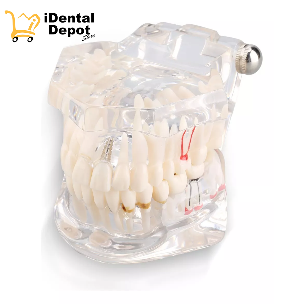 Tipodonto Didáctico Patologías-tx Implantes